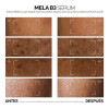 Sérum La Roche Posay Mela B3 Antimanchas 30ml Sérum La Roche Posay Mela B3 Antimanchas 30ml