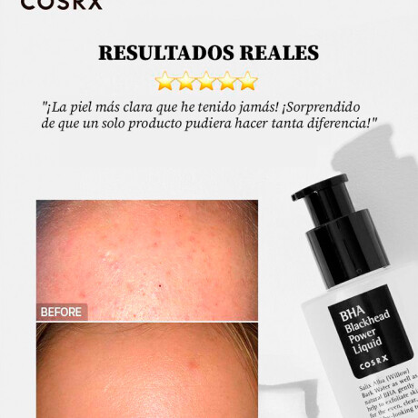 BHA BLACKHEAD POWER LIQUID COSRX - Exfoliante químico para eliminar puntos negros (70%OFF por vencimiento en Julio) BHA BLACKHEAD POWER LIQUID COSRX - Exfoliante químico para eliminar puntos negros (70%OFF por vencimiento en Julio)