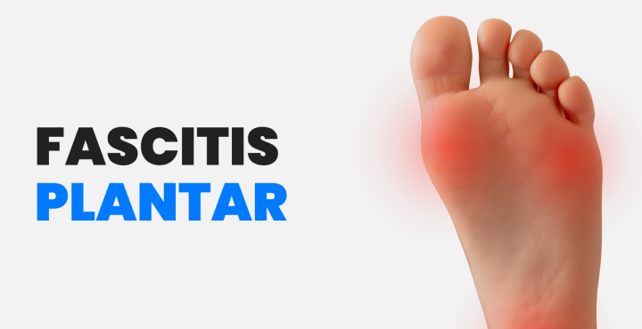 Fascitis plantar