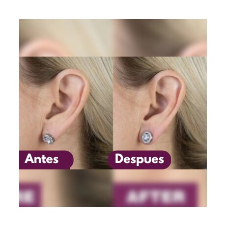 CORRECTORES DE OREJAS PARA CARAVANAS UN PAR 14.3*10MM PLATA