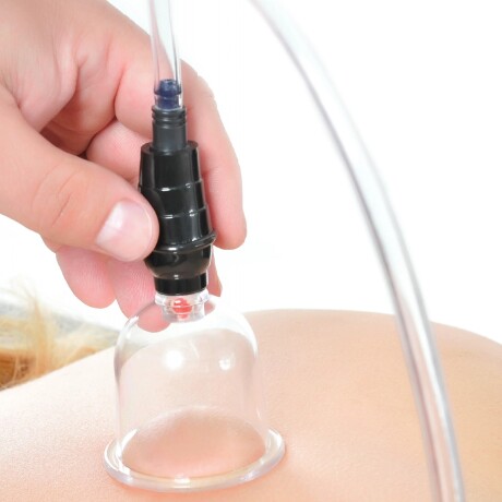 FF Series Beginner's 6 Piece Cupping Set FF Series Beginner's 6 Piece Cupping Set