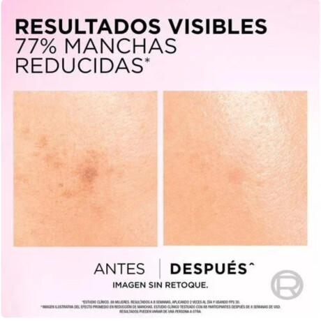 Sérum L'Oréal París Antimanchas Glycolic Bright 30 ml