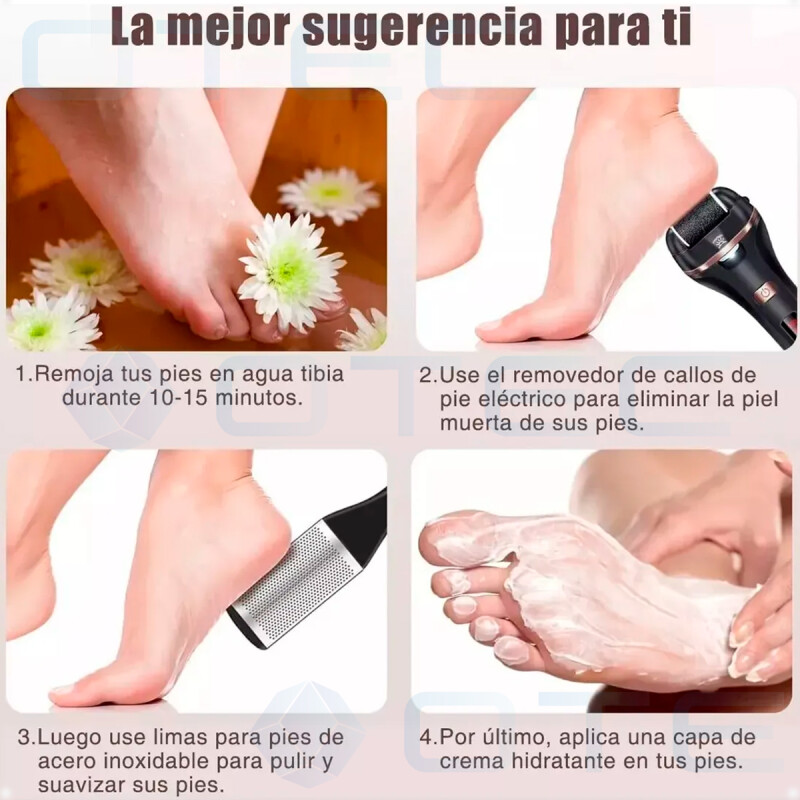 Removedor De Callos Eléctrico Con Accesorios Removedor De Callos Eléctrico Con Accesorios