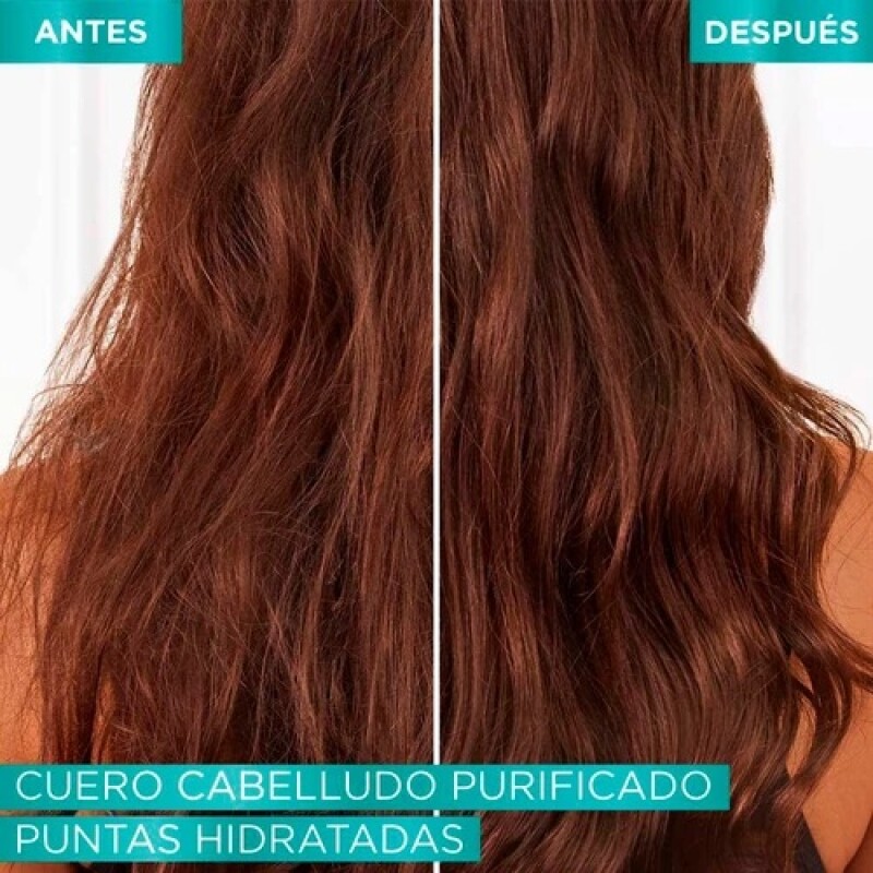 Acondicionador Hidra Hialuronico Pure Elvive 370 ml Acondicionador Hidra Hialuronico Pure Elvive 370 ml