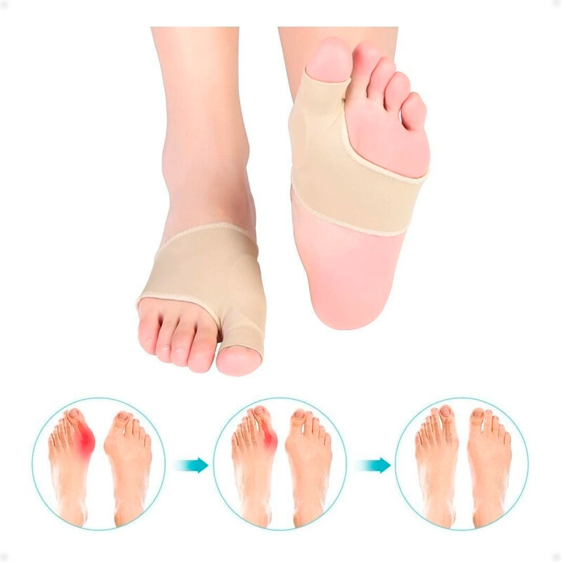 Protector Corrector De Juanetes OrtopÃ©dico Gel Silicona Par Protector Corrector De Juanetes OrtopÃ©dico Gel Silicona Par