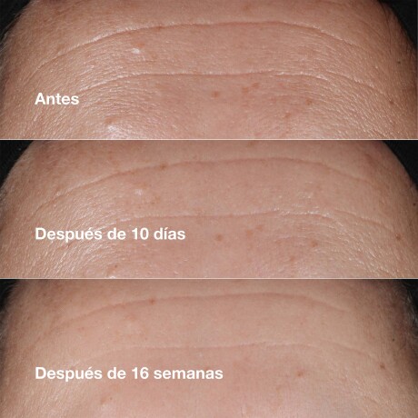 Cl Smart Repair Wrinkle Correcting Serúm Cl Smart Repair Wrinkle Correcting Serúm