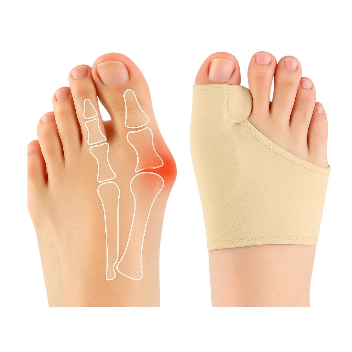 Soporte de Gel Corrector de Juanetes - BEIGE 