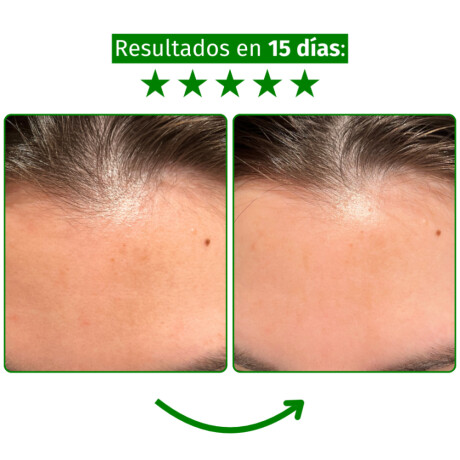 Sérum Facial Alma Retinol 0.2% Antiedad 30ml Sérum Facial Alma Retinol 0.2% Antiedad 30ml