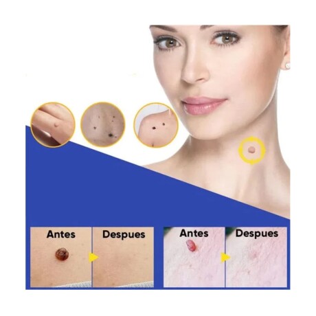 Kit Eliminador de Verrugas 40 Piezas 001