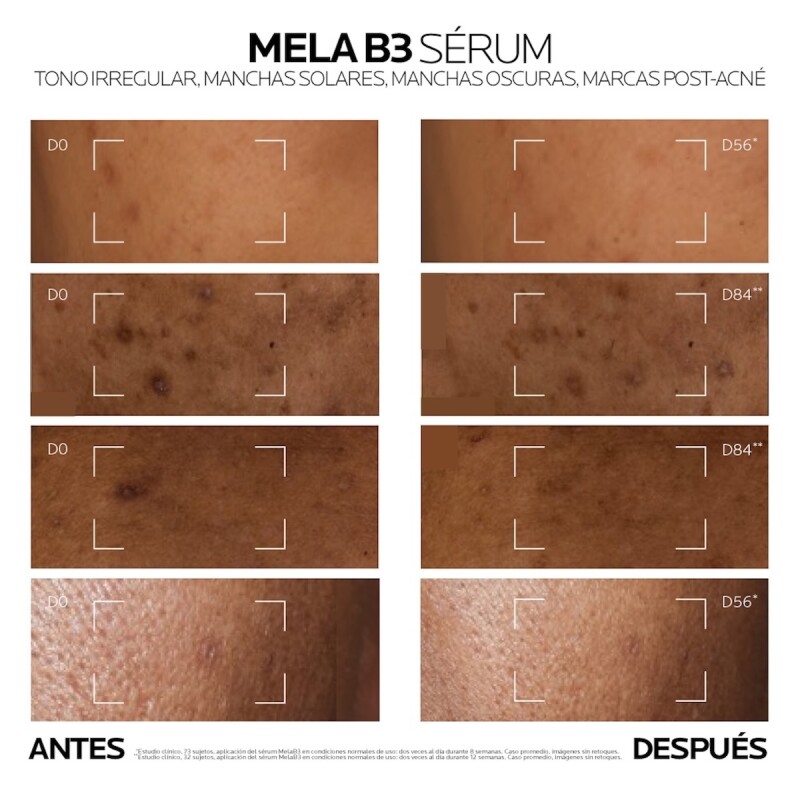 Mela B3 La Roche Posay Serum Antimanchas Concentrado 30 Ml. Mela B3 La Roche Posay Serum Antimanchas Concentrado 30 Ml.