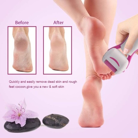 Kit de Pedicura Embellecedor de Pies Eléctrico 001