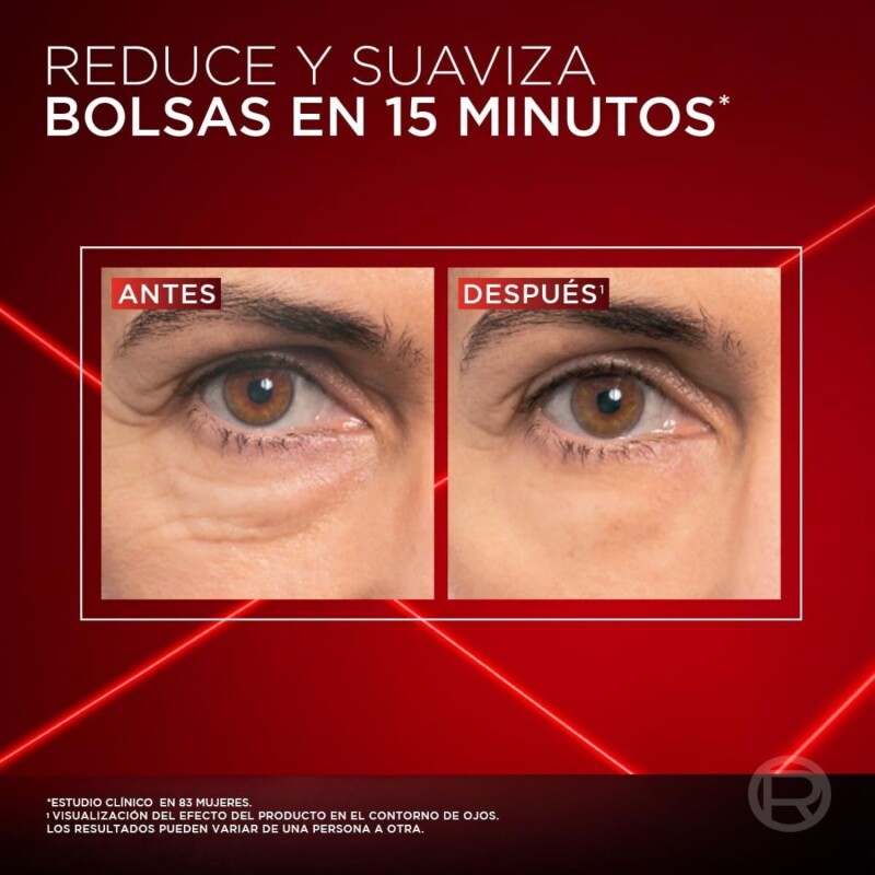 Crema Contorno De Ojos Loreal Paris Revitalift Laser 15 Ml Crema Contorno De Ojos Loreal Paris Revitalift Laser 15 Ml