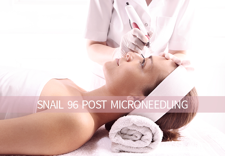 EL MICRONEEDLING Y POST TRATAMIENTO CON LA ESENCIA SNAIL 96