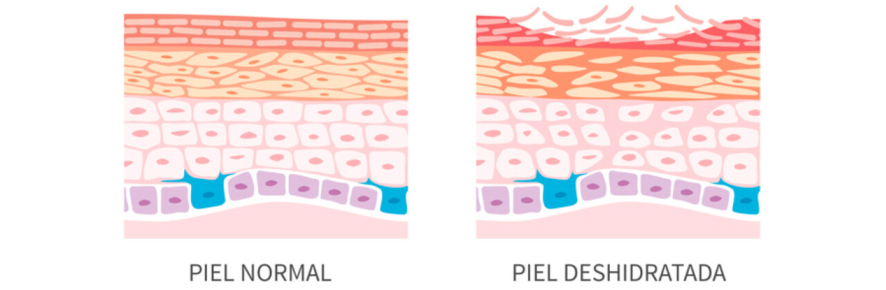 1-piel-normal-piel-seca.jpg