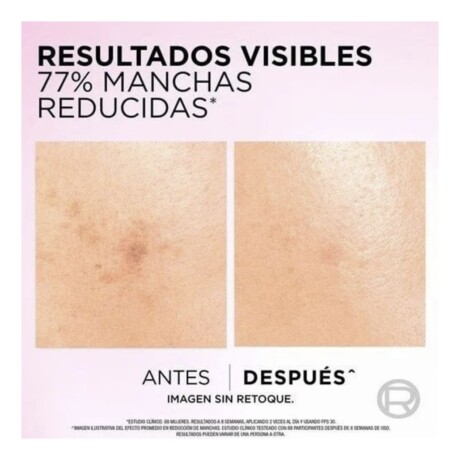Serum Anti Manchas Loreal París Glycolic Bright - 30ml Serum Anti Manchas Loreal París Glycolic Bright - 30ml