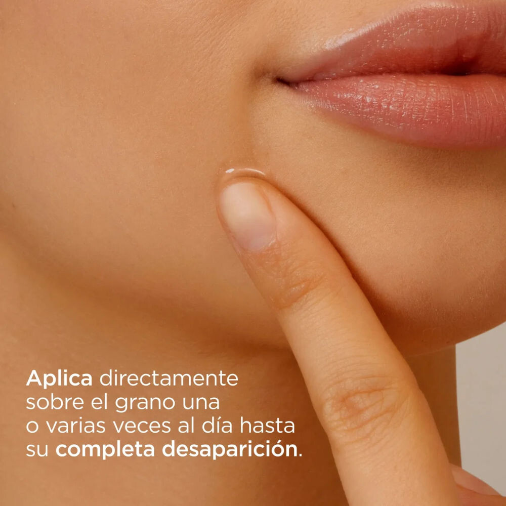 Tratamiento Facial Antiacné Acniben® On The Spot 15ml
