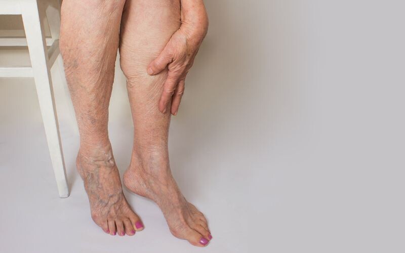 Piernas cansadas: causas, síntomas y cómo aliviarlas de forma natural