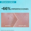 Serum Protector Solar Garnier Anti-Imperfecciones FPS50 40ml Serum Protector Solar Garnier Anti-Imperfecciones FPS50 40ml