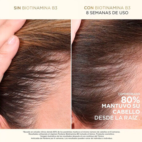 Tónico Pantene Biotinamina Anti Caída 60ml Tónico Pantene Biotinamina Anti Caída 60ml