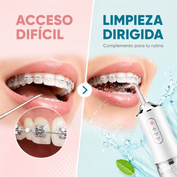 Irrigador Limpiador Oral Bucal Dental Brackets Profesional Blanco