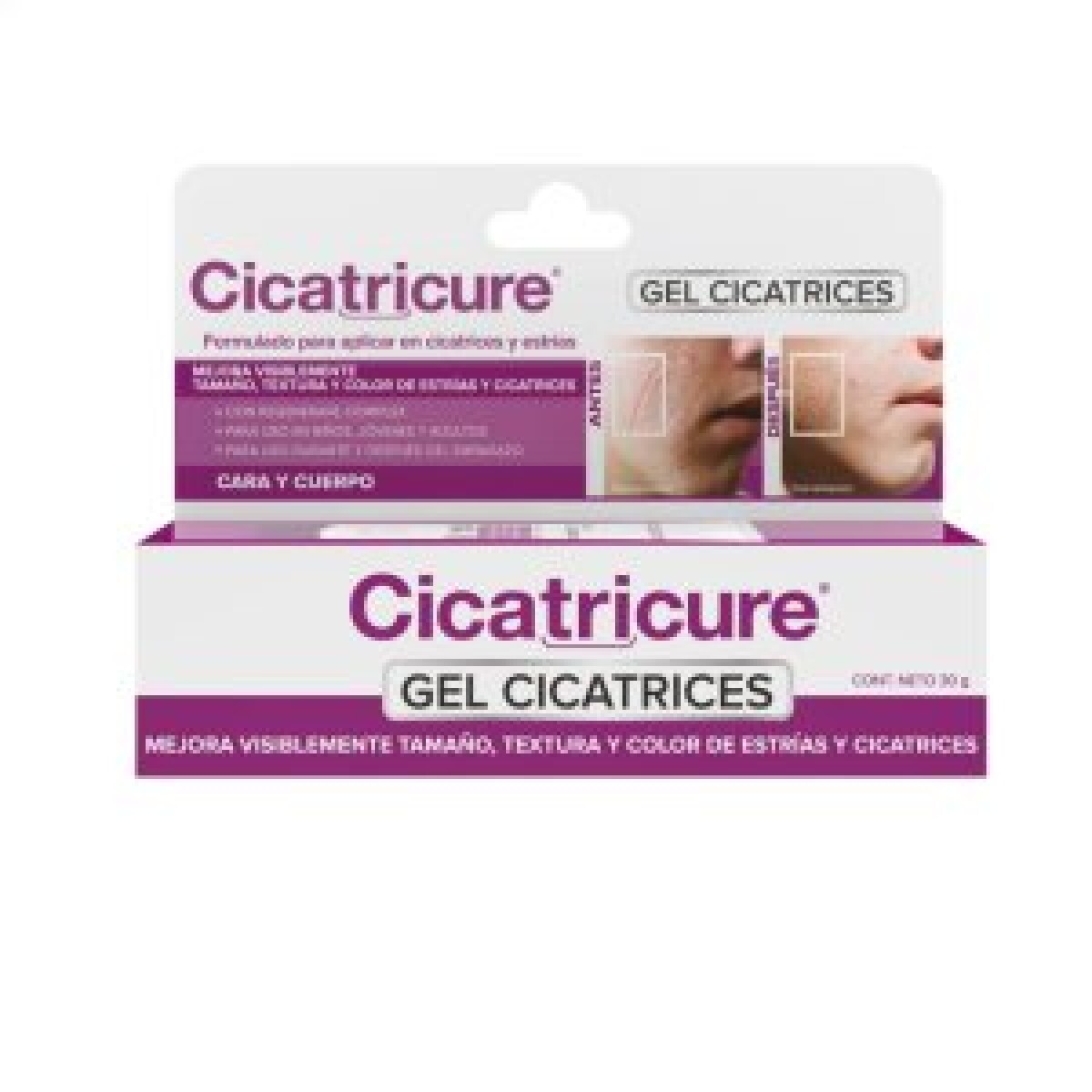 Cicatricure Gel para Cicatrices 60 gr | Reduce Marcas y Mejora la Textura de la Piel 