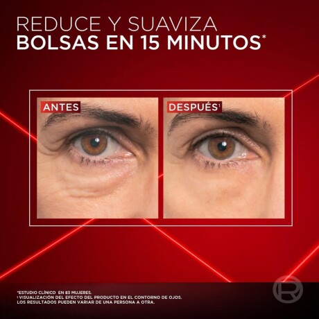 Crema Contorno De Ojos Loreal Paris Revitalift Laser 15 Ml Crema Contorno De Ojos Loreal Paris Revitalift Laser 15 Ml