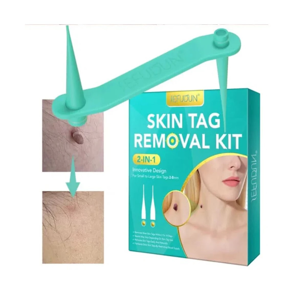 KIT DE ELIMINACIÓN DE VERRUGAS 40 PIEZAS 