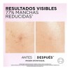 Serum Anti Manchas Loreal París Glycolic Bright - 30ml Serum Anti Manchas Loreal París Glycolic Bright - 30ml