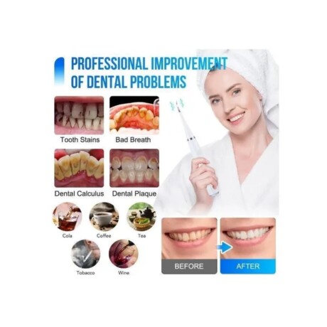 ESCALADOR DENTAL LIMPIADOR DE SARRO RECARGABLE USB NEGRO