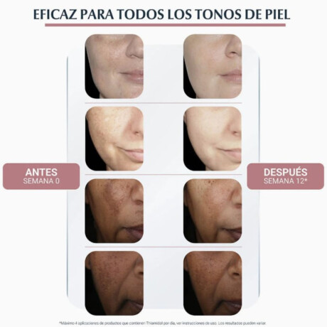 Sérum Eucerin Dúo Antipigment Double 30ml Sérum Eucerin Dúo Antipigment Double 30ml