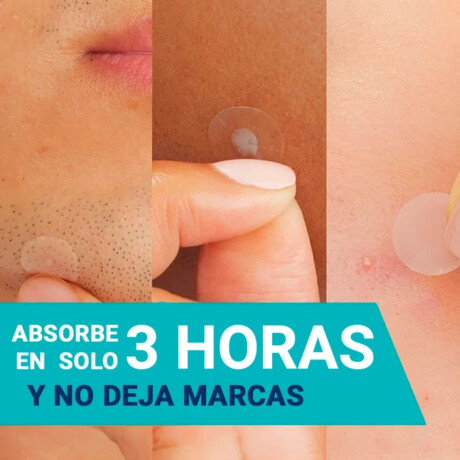 Parches CeraVe Anti-Imperfecciones Acné 22 Unidades Parches CeraVe Anti-Imperfecciones Acné 22 Unidades