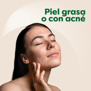 Piel con acne