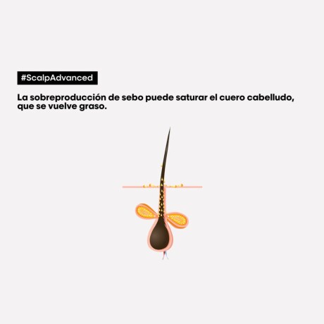 Shampoo L'Oréal Prof Anti-Oleosidad 500ml Shampoo L'Oréal Prof Anti-Oleosidad 500ml