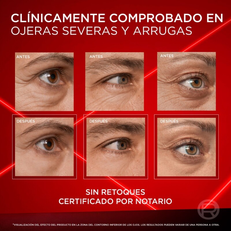 Contorno De Ojos L'oreal Paris Revitalift Laser 15 Ml. Contorno De Ojos L'oreal Paris Revitalift Laser 15 Ml.