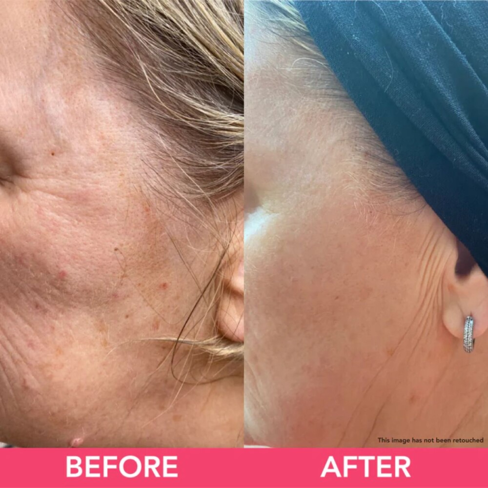 Teaology Crema Antiedad Milagro de Te Blanco 50ml Teaology Crema Antiedad Milagro de Te Blanco 50ml